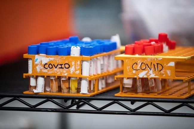 Specimens to be tested for COVID-19 are seen in Surrey, B.C., on Thursday, March 26, 2020. Health officials in New Brunswick are reporting 10 new cases of COVID-19 today. THE CANADIAN PRESS/Darryl Dyck