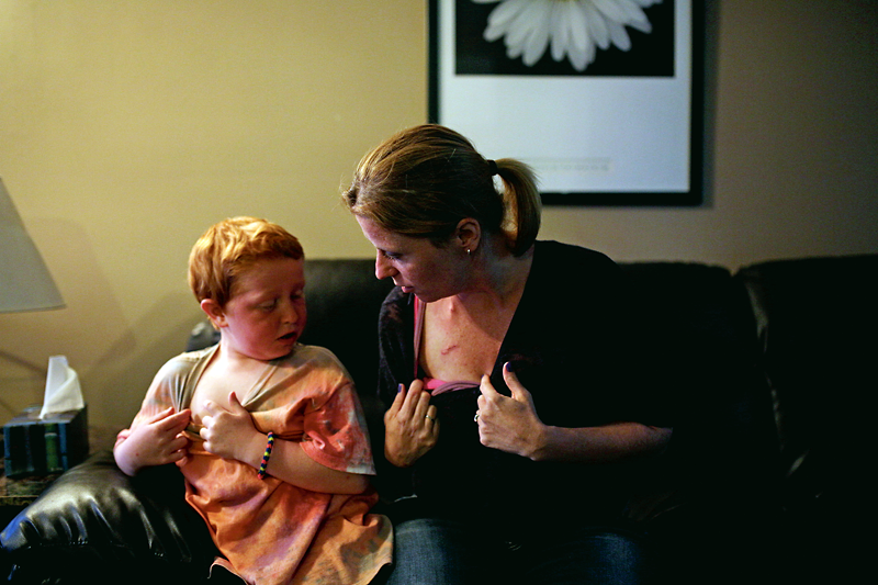 Tim Smith/Brandon Sun
Cheryl Mauthe, right, and her son Colin compare scars from their ports that they use to receive their chemotherapy treatments. Brandon Sun photographer Tim Smith was nominated in the local reporting category at the National Newspaper Awards for the three-part series Testing Positive, which tracked Cheryl and Colin’s cancer battle.