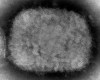 This 2003 electron microscope image made available by the Centers for Disease Control and Prevention shows a monkeypox virion, obtained from a sample associated with the 2003 prairie dog outbreak. Monkeypox, a disease that rarely appears outside Africa, has been identified by European and American health authorities in recent days. THE CANADIAN PRESS/HO - AP, CDC - Cynthia S. Goldsmith, Russell Regner