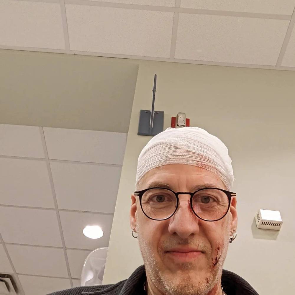 Dwayne Dyck is seen in a photo he took of himself after getting treatment at Brandon hospital following a robbery Friday afternoon during which he was struck on the head with a baton. (Facebook)