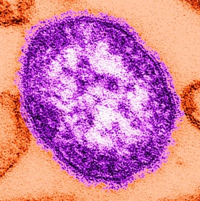 The Quebec government says thousands of people might have been exposed to measles at a shopping mall north of Montreal earlier this month, as an outbreak of the highly contagious disease continues to grow. This undated image made available by the Centers for Disease Control and Prevention on Feb. 4, 2015, shows an electron microscope image of a measles virus particle, centre. THE CANADIAN PRESS/AP-Cynthia Goldsmith/Centers for Disease Control and Prevention via AP