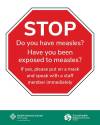 Digital version of the measles screening signs that have been put around the Health Sciences Centre in Winnipeg. (HSC)
