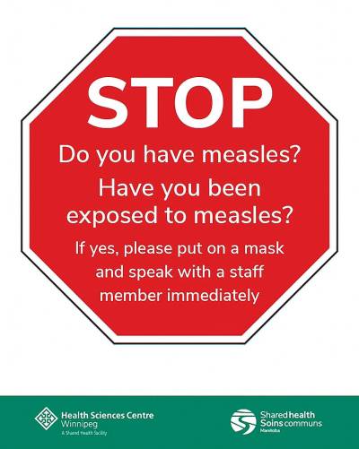 Digital version of the measles screening signs that have been put around the Health Sciences Centre in Winnipeg. (HSC)