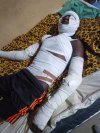 In this photo released by Amnesty International Nigeria, a patient receives treatment at the Yariman Bakura Specialist hospital in Gusau, Nigeria, Monday, May 11, 2026, after a Nigerian military airstrike struck a market on Sunday. (Amnesty International Nigeria Via AP)