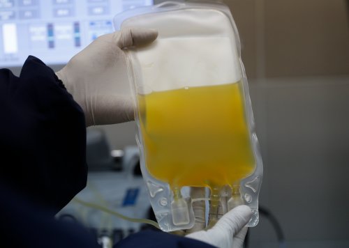 Health Canada says it gave a non-compliance rating to Grifols, a private clinic which has paused plasma collection across Canada. In this Friday, June 12, 2020 file photo, a doctor holds a bag of blood plasma donated at blood bank in La Paz, Bolivia. (AP Photo/Juan Karita, FILE)